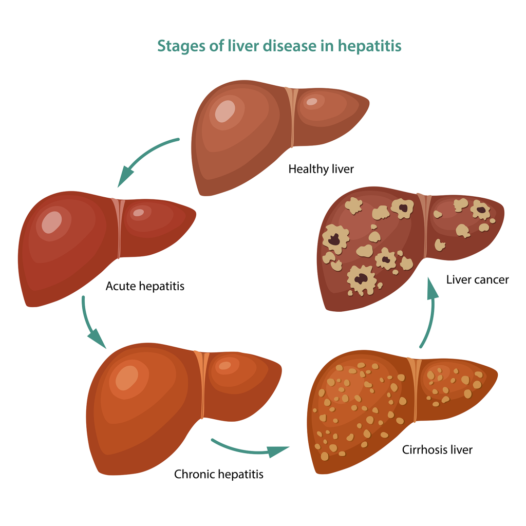 Hepatitis panel empire city laboratories medical lab testing